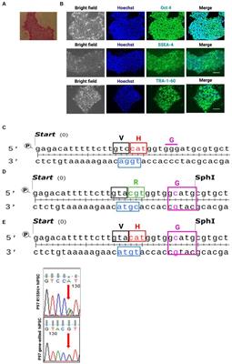 Skeletal muscle cell protein dysregulation highlights the pathogenesis mechanism of myopathy-associated p97/VCP R155H mutations